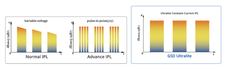 Aппарат IPL-терапии Ultralight фото 6