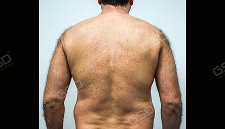 Диодный лазер COOLITE BOLT 1800W фото 5